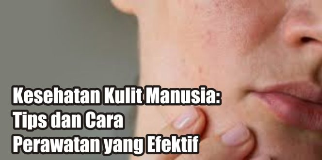 
					Ilustrasi Kulit. F: Net